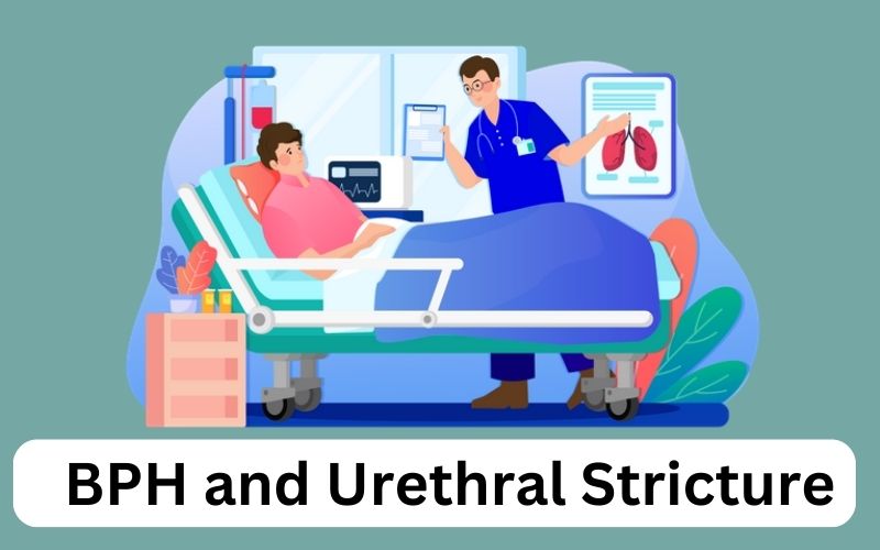 Top 10 Surprising Ways Difference Between BPH and Urethral Stricture Can Affect Your Health